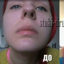 ВИДЕО: Анастасия Шпагина стала жертвой пластического хирурга